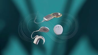 imgi_5_Implantat und SPs